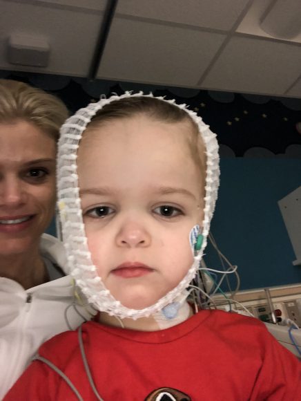 a special needs child with bandages wrapped around his head as his mom is seen in the background