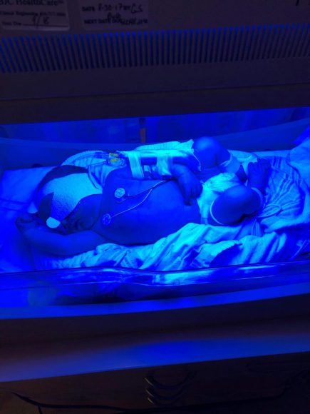 a premature infant under a blue bill light in the NICU